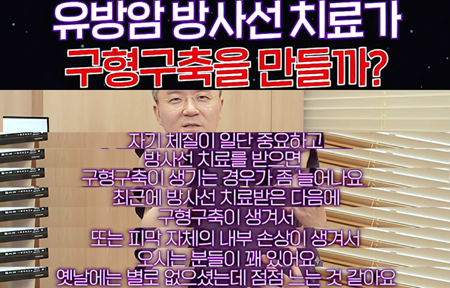 유방암 방사선 치료가 구형구축을 만들까?