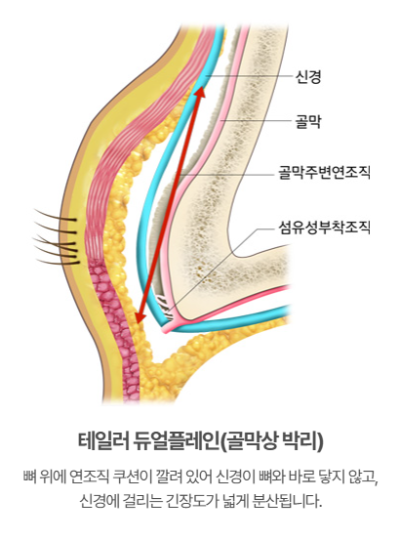 이마거상술·이마거상, 눈썹만 올리면 끝일까요? 수술층과 신경 보호의 핵심 | 테일러성형외과 사진 6