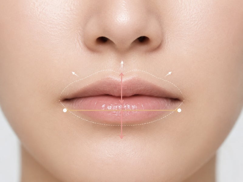 입술필러를 맞아도 왜 입이 짧아 보일까요? | 강남 입술필러 | 골든디아망성형외과