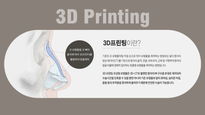 첨단 기술과 코 성형의 만남, 3D 가상 성형에 대하여