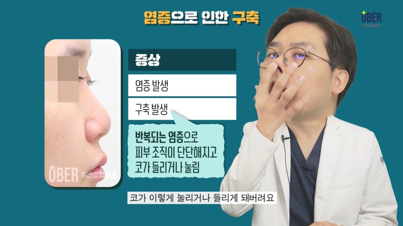 위버성형외과 서승조 원장님이 알려주는 코재수술 유형! 염증, 구축, 모양의 불만족 등의 원인을 함께 확인해볼까요?