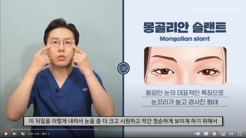 [위버스성형외과] 뒤밑트임 수술 방식 종류와  중요 포인트를 알고 가세요!