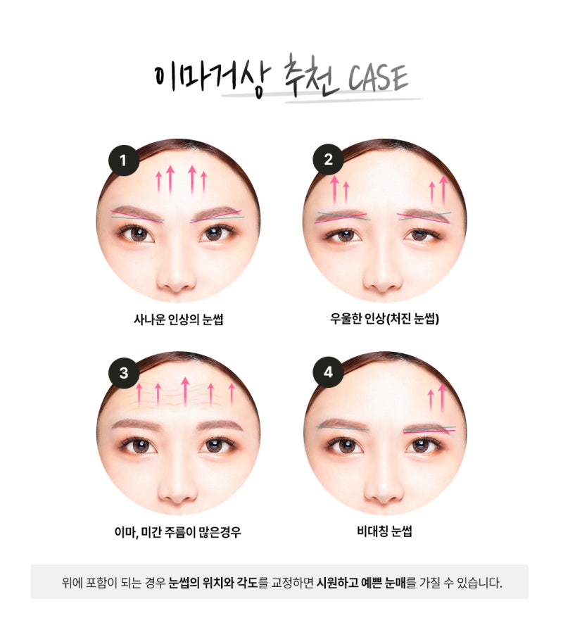 이마거상(엔도타인)이란?