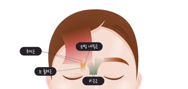 미간쪽이 찌푸려져서 주름이 생기고 눈매가 처지는게 스트레스인데 이마거상하면 교정이 될까요?
