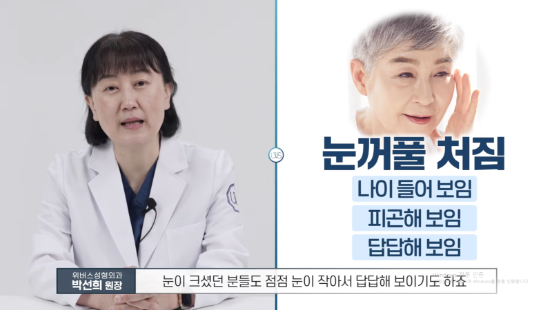 상안검 VS 눈썹하거상, 나에게 맞는 수술은?