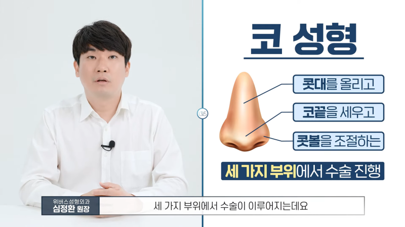 자가늑연골 코성형 장단점