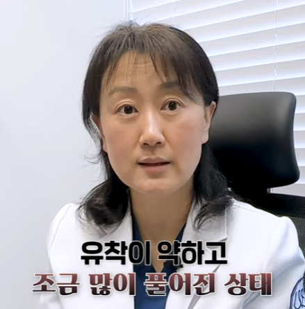 Is Lowering the Double Eyelid Line Only Possible Through Incision?