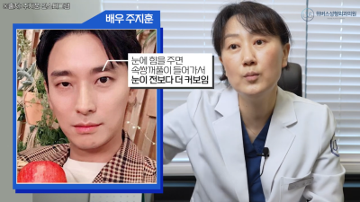 V (BTS) và Ju Ji-hoon cũng sở hữu đôi mắt không đều?! Các ngôi sao có cần chỉnh sửa mắt không đều không?
