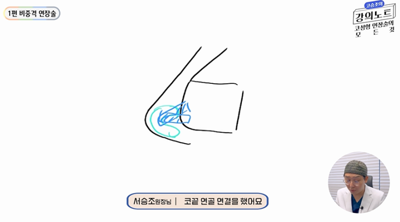 [코승조의 강의노트]비중격 연장술 1편