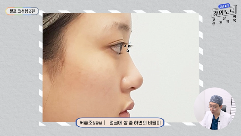 [코승조의 강의노트] 코성형 포토샵 잘하기2편