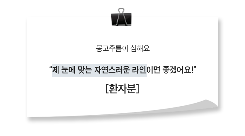 [실환 케이스 리뷰] 절개 상꺼풀, 앞트임