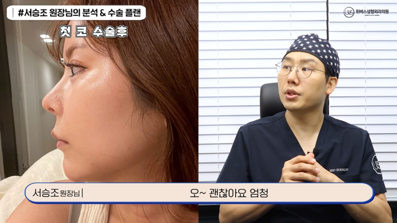 가장 까다롭다는 코재재수술?😭(자가늑 코재재수술)
