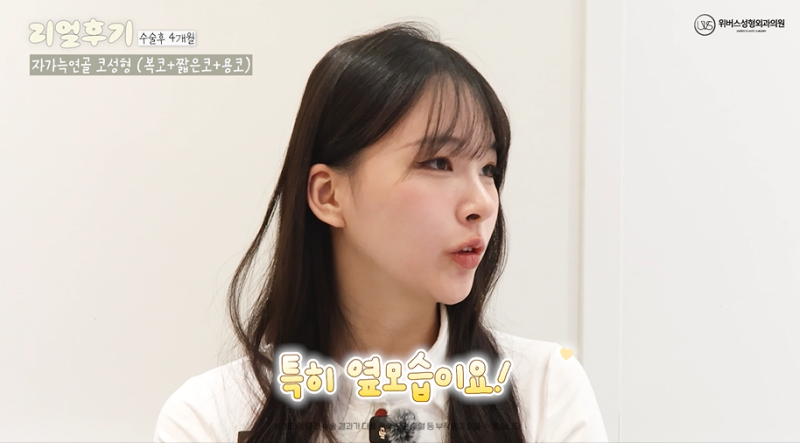인생 코 갱신👃코수술 [2편] (자가늑, 직반코, 복코수술)