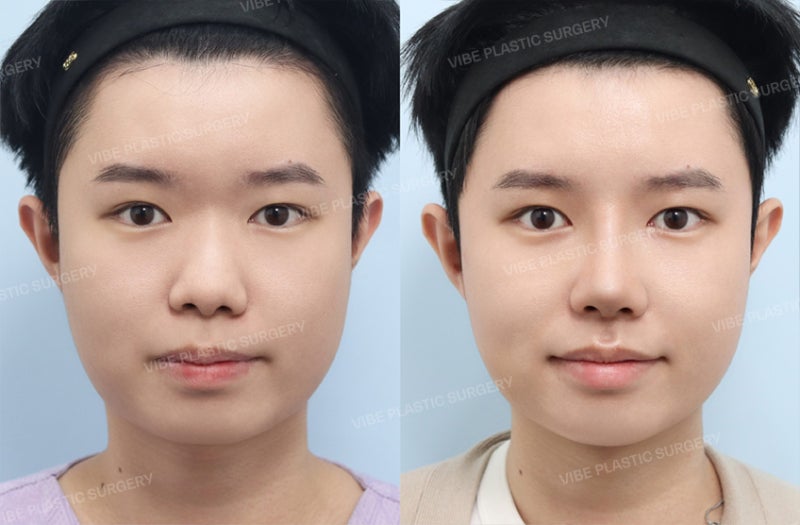 바이브성형외과 커버 이미지