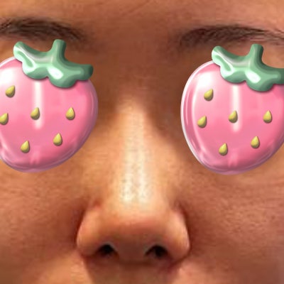 짧아진 코, 다시 길게 만들 수 있을까? (자가늑연골 코성형) by 신논현역 바이브 성형외과 유영문 원장 사진 9