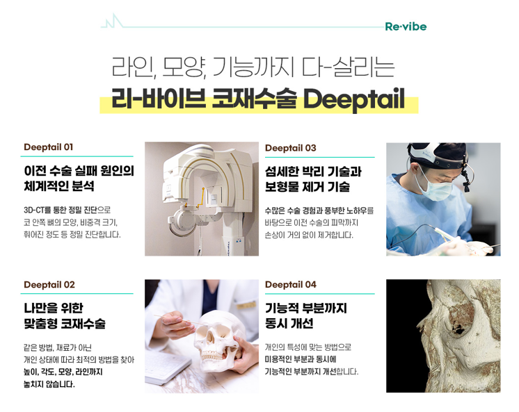 코재수술 신중하게 고민해서 결정해야 해요