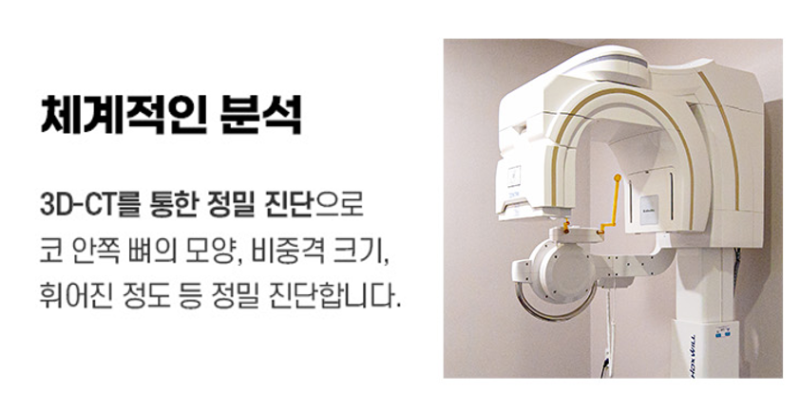 매부리코 무조건 깎는게 정답일까요?