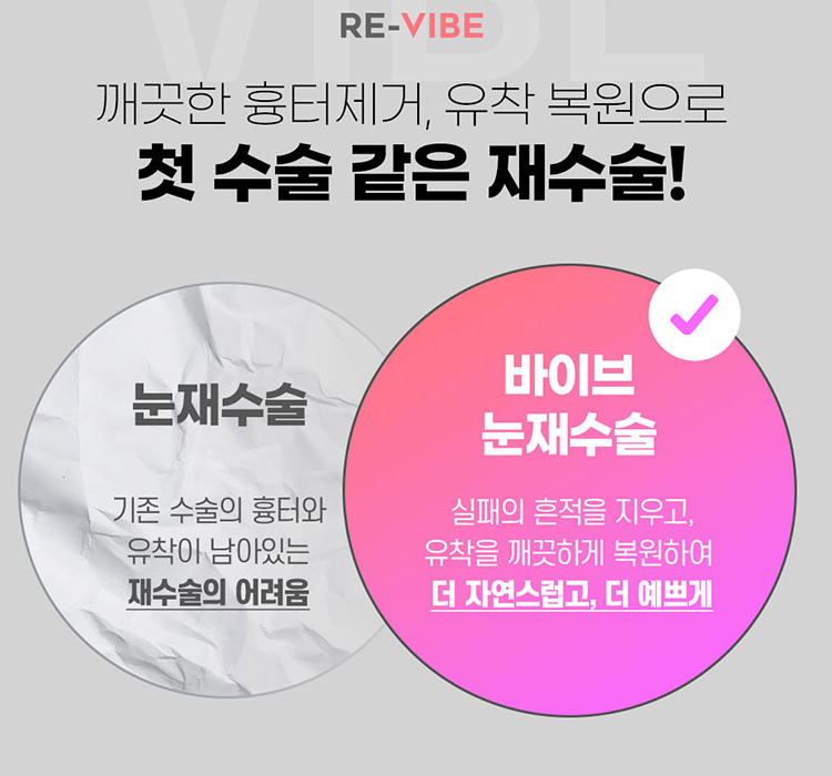 쌍꺼풀눈재수술 실패 원인과 분석이 중요합니다