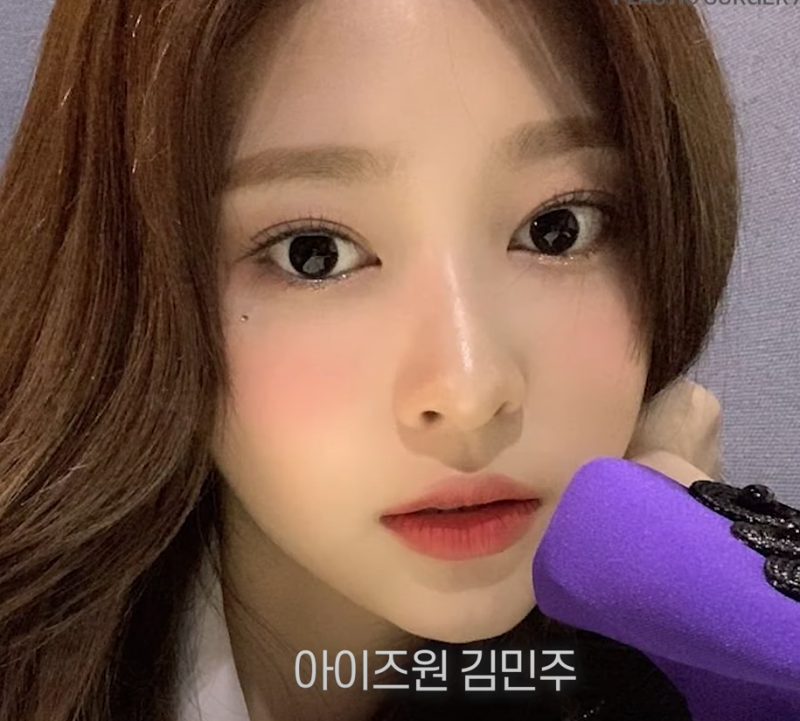 바이브성형외과에서 정리해드리는 나에게 맞는 쌍꺼풀라인