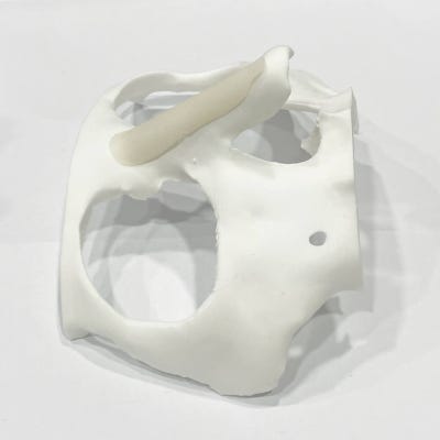 🧩🧬Fit-Me Implants Custom-Made for Your Nose Bridge | Sinnonhyeon Nose Surgery VIBE Plastic Surgery