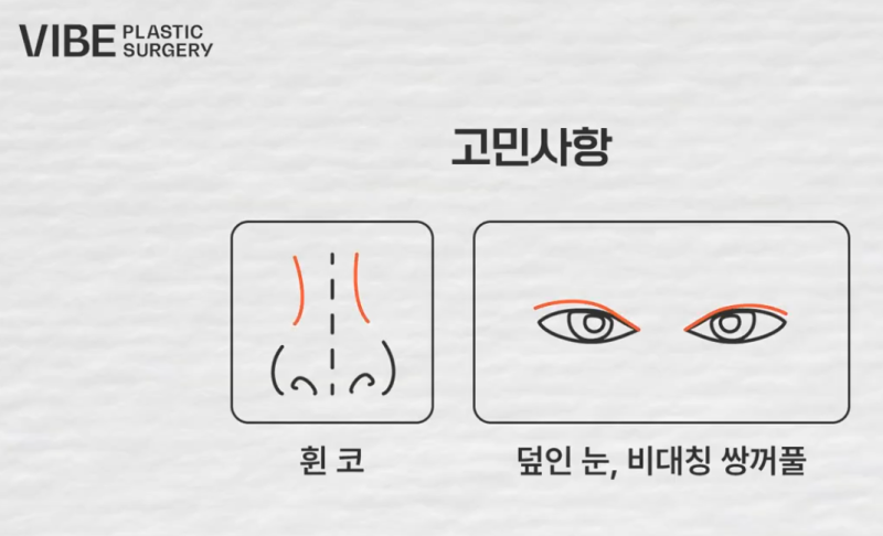 Harmonizing Clearer Eyes and First Rhinoplasty, Gangnam Rhinoplasty VIBE Plastic Surgery｜VIBE PICK Eye Revision Surgery & First Rhinoplasty Case💜