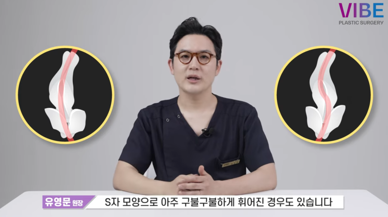 기능코성형 비염코수술, 코 모양과 호흡까지 개선하는 방법