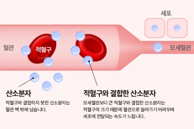 ✨고압산소치료, 수술 후 회복 관리의 새로운 선택지|바이브성형외과에서 경험해보세요