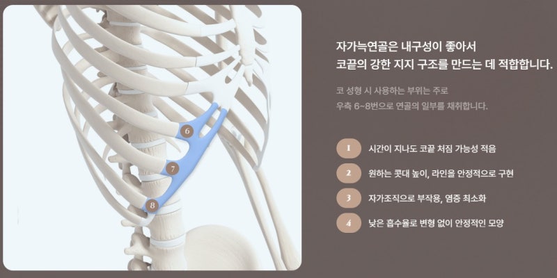 코재수술 시기 언제가 좋을까? 코성형 부작용 증상과 대처법 총정리! 사진 6